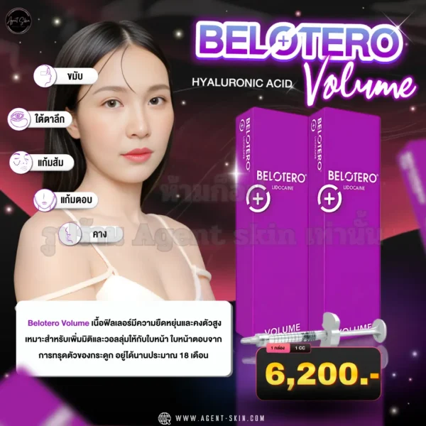 Belotero Volume