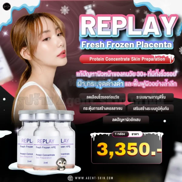 replay placenta